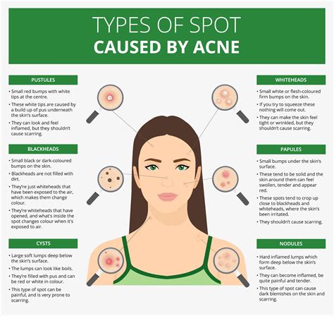 What Causes Acne In Adults