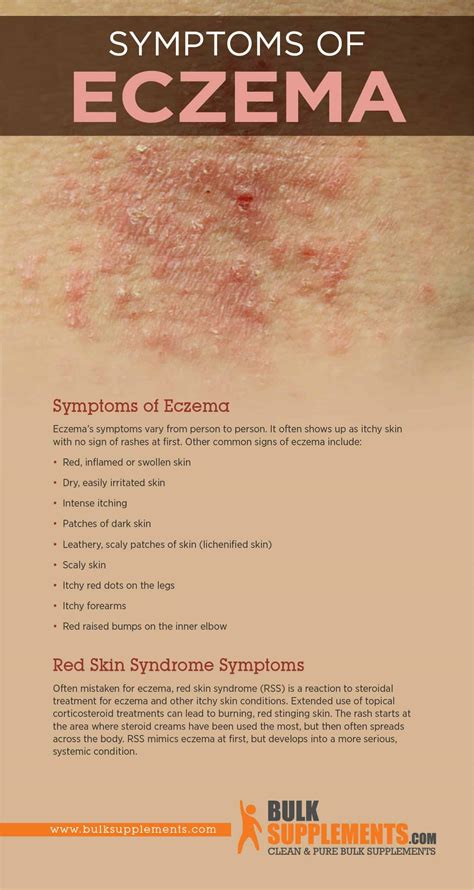 What Causes Itching With Eczema